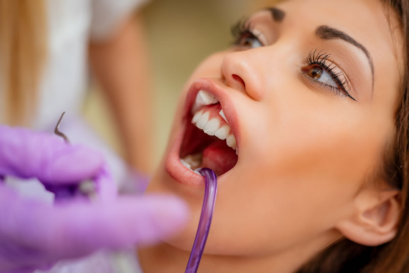 Dental Filling procedure