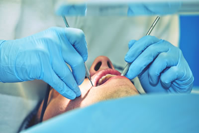 Tooth Extraction Galway
